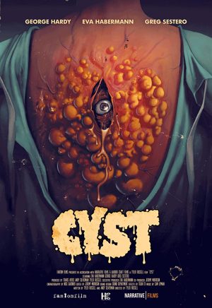 فيلم Cyst 2020 مترجم اون لاين